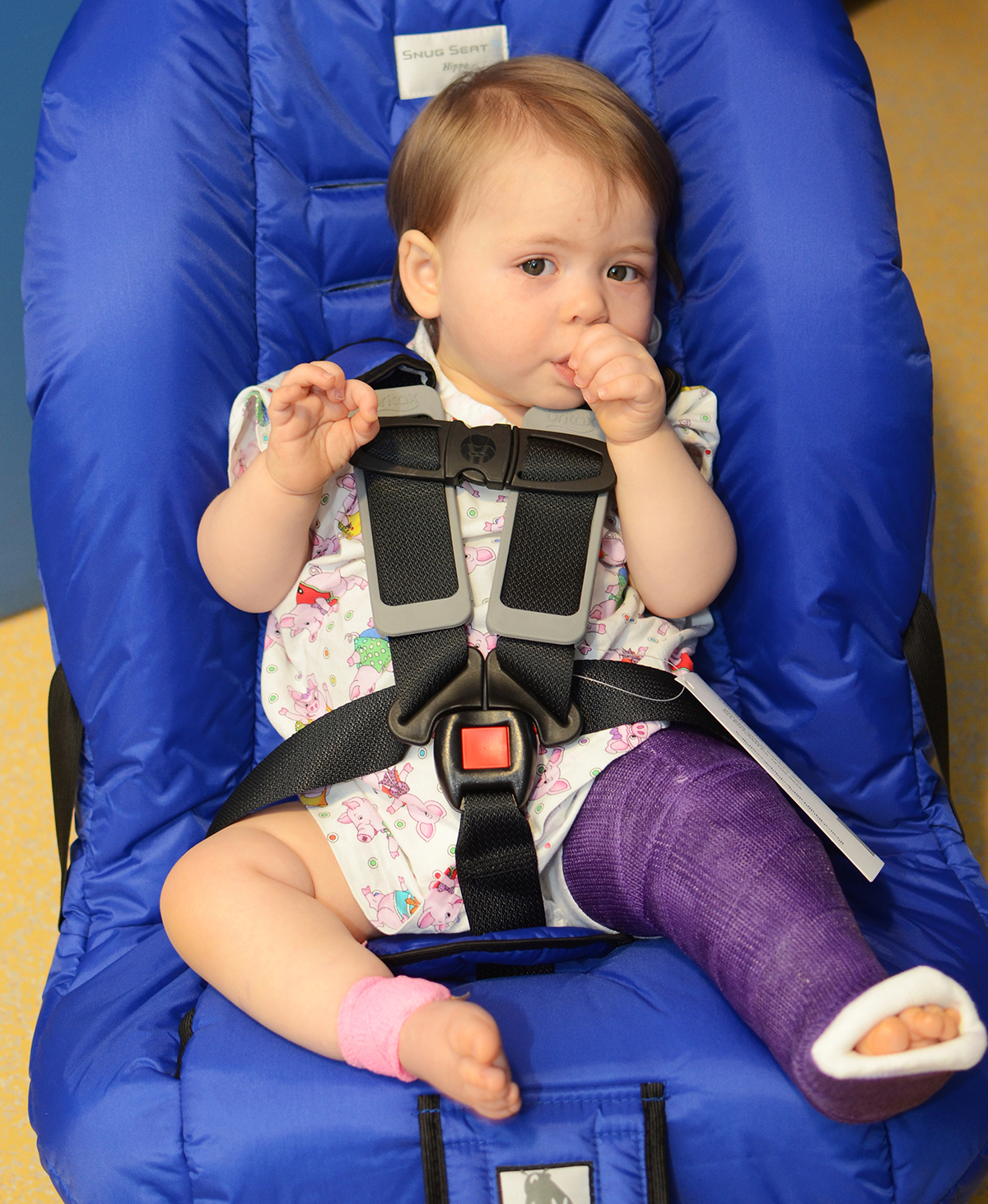 Scottish Rite for Children occupational therapy patient in leg cast